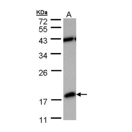 PDE6D antibody from Signalway Antibody (22703) - Antibodies.com