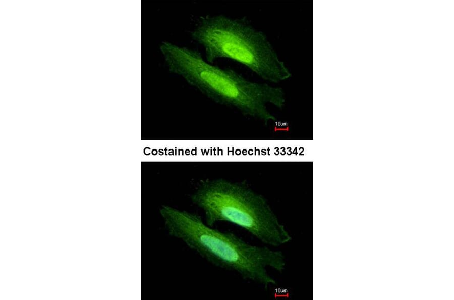 Immunofluorescence - PDE6D antibody from Signalway Antibody (22703) - Antibodies.com