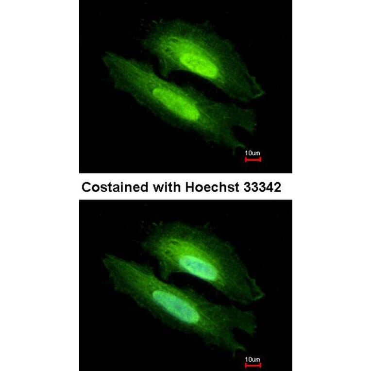 Immunofluorescence - PDE6D antibody from Signalway Antibody (22703) - Antibodies.com
