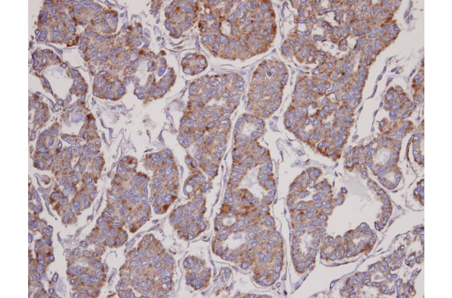 Immunohistochemistry - FBL6 antibody from Signalway Antibody (22708) - Antibodies.com