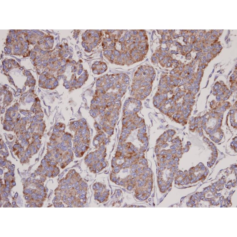Immunohistochemistry - FBL6 antibody from Signalway Antibody (22708) - Antibodies.com