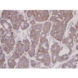 Immunohistochemistry - FBL6 antibody from Signalway Antibody (22708) - Antibodies.com