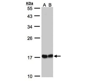 HSPB8 antibody from Signalway Antibody (22713) - Antibodies.com