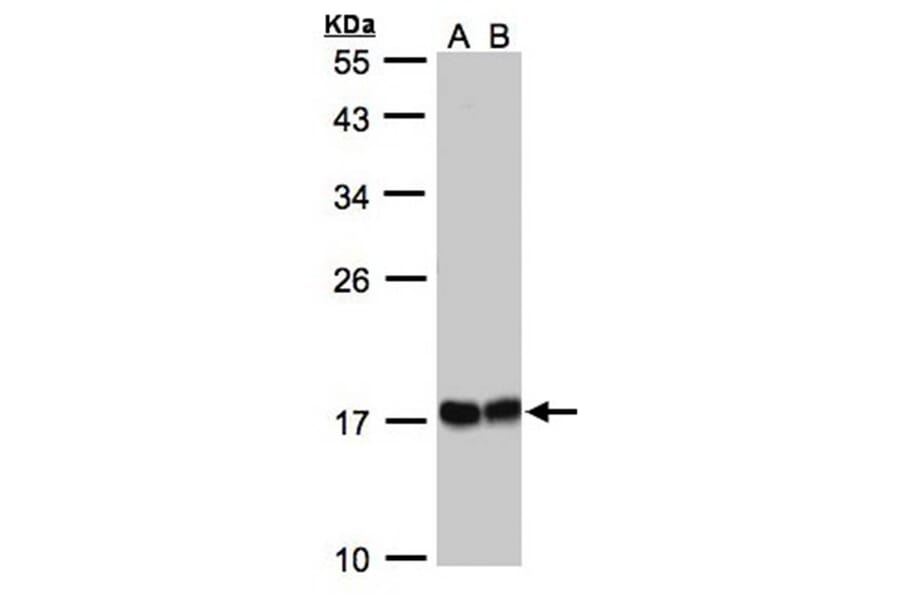 HSPB8 antibody from Signalway Antibody (22713) - Antibodies.com