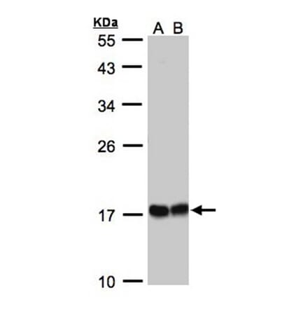 HSPB8 antibody from Signalway Antibody (22713) - Antibodies.com