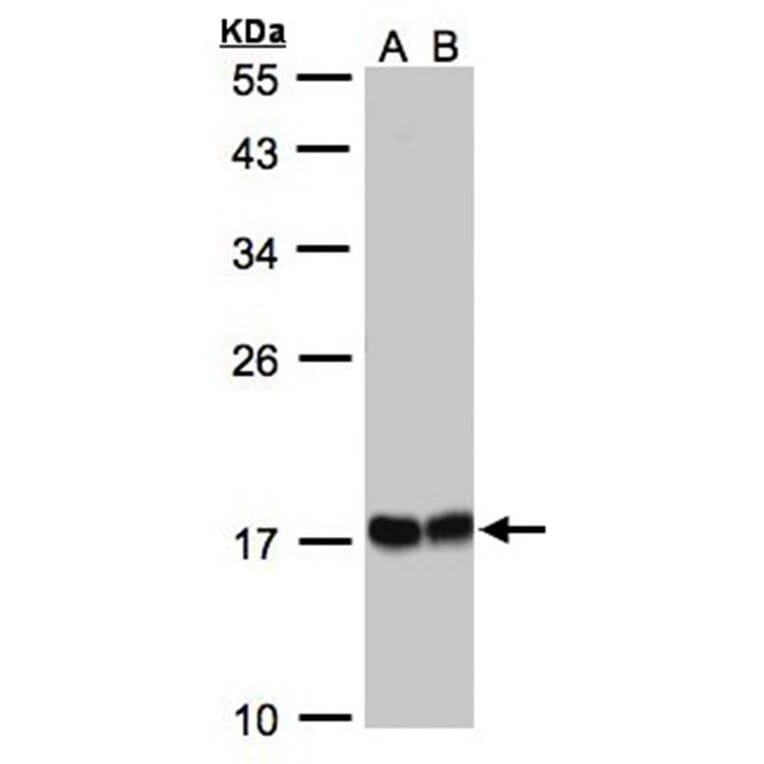HSPB8 antibody from Signalway Antibody (22713) - Antibodies.com