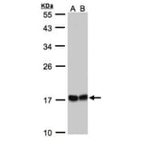 HSPB8 antibody from Signalway Antibody (22713) - Antibodies.com