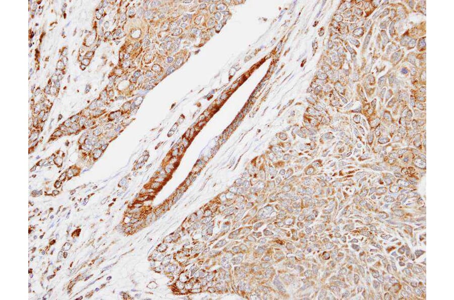 Immunohistochemistry - HSPB8 antibody from Signalway Antibody (22713) - Antibodies.com