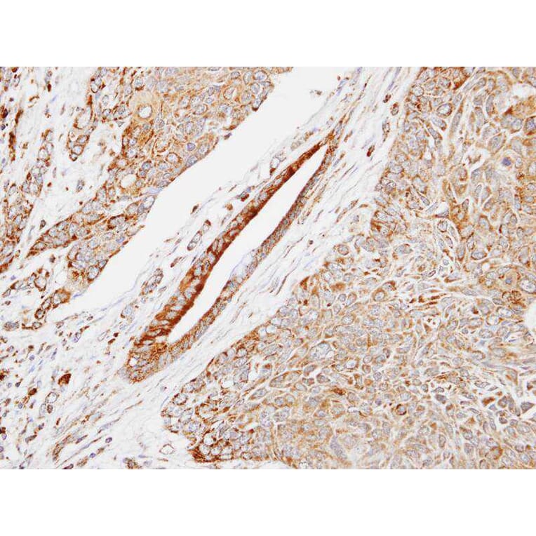 Immunohistochemistry - HSPB8 antibody from Signalway Antibody (22713) - Antibodies.com
