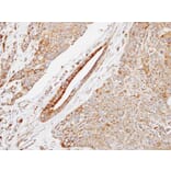 Immunohistochemistry - HSPB8 antibody from Signalway Antibody (22713) - Antibodies.com