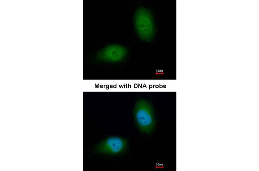 Immunofluorescence - HSPB8 antibody from Signalway Antibody (22713) - Antibodies.com