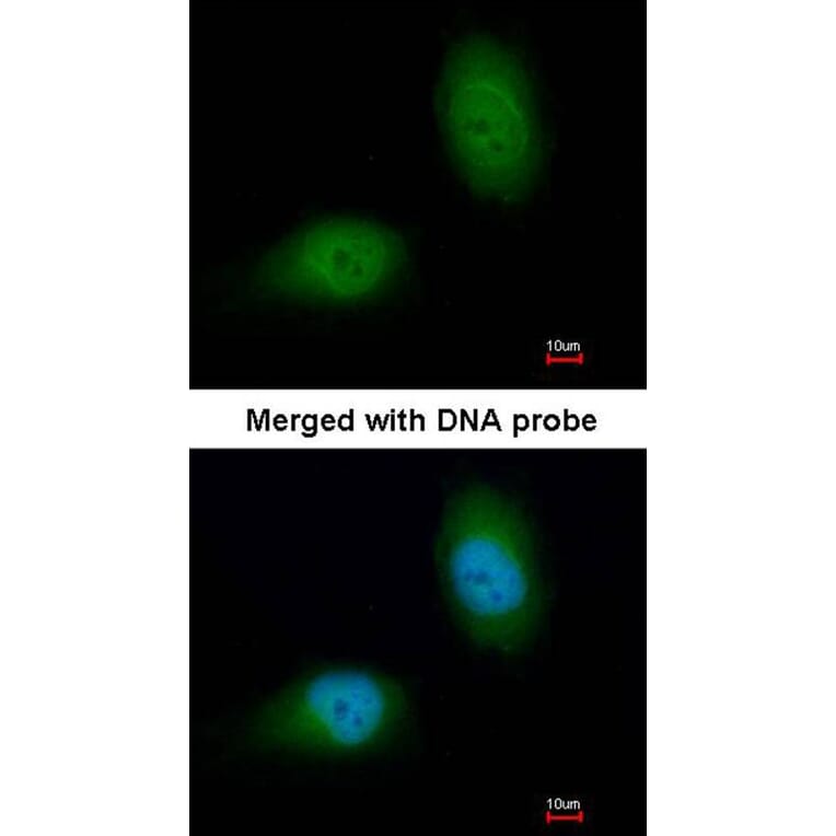 Immunofluorescence - HSPB8 antibody from Signalway Antibody (22713) - Antibodies.com