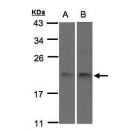 SNX12 antibody from Signalway Antibody (22717) - Antibodies.com