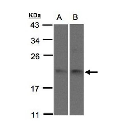 SNX12 antibody from Signalway Antibody (22717) - Antibodies.com