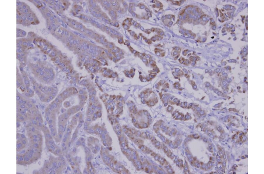 Immunohistochemistry - SNX12 antibody from Signalway Antibody (22717) - Antibodies.com