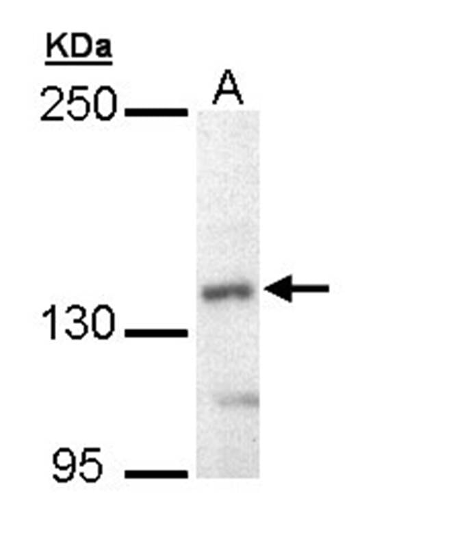 Sample (30 µg of whole cell lysate) Hep G2 5% SDS PAGE Primary antibody diluted at 1: 10000