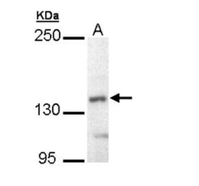 UBE4B antibody from Signalway Antibody (22741) - Antibodies.com