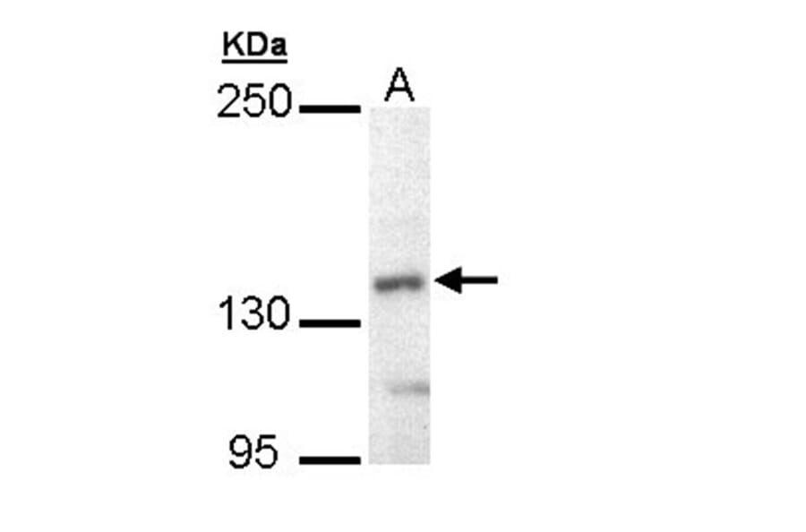 UBE4B antibody from Signalway Antibody (22741) - Antibodies.com