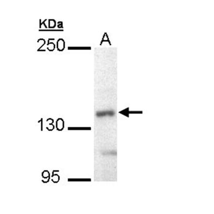 UBE4B antibody from Signalway Antibody (22741) - Antibodies.com