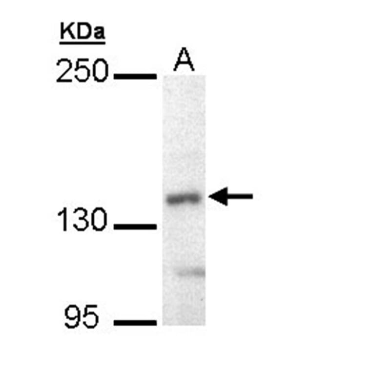 UBE4B antibody from Signalway Antibody (22741) - Antibodies.com