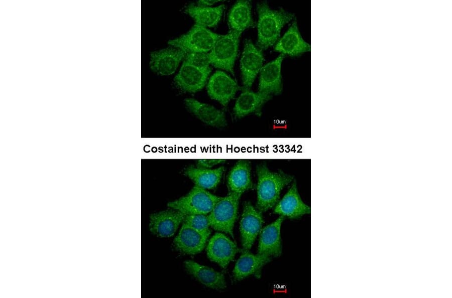 Immunofluorescence - UBE4B antibody from Signalway Antibody (22741) - Antibodies.com