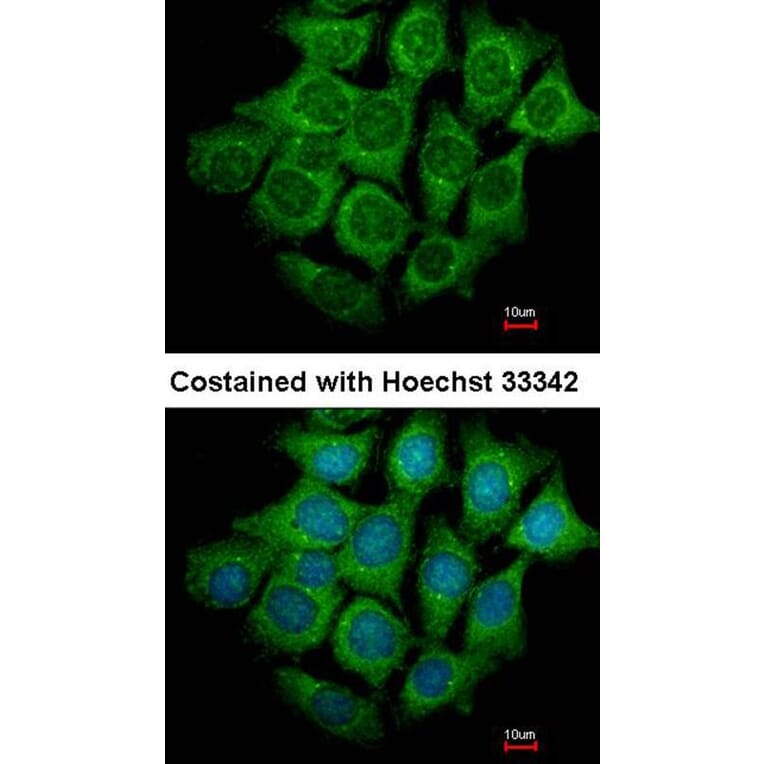 Immunofluorescence - UBE4B antibody from Signalway Antibody (22741) - Antibodies.com