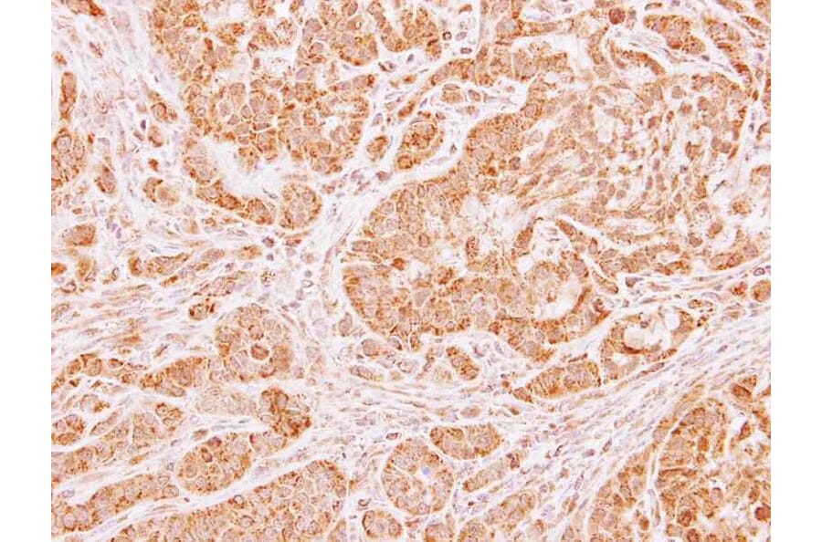 Immunohistochemistry - LARS2 antibody from Signalway Antibody (22745) - Antibodies.com