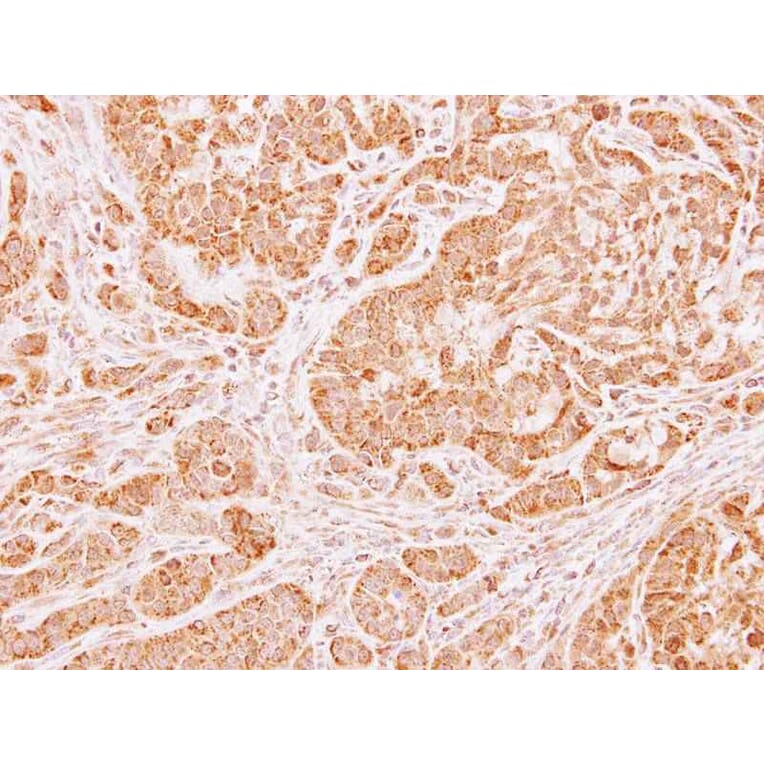 Immunohistochemistry - LARS2 antibody from Signalway Antibody (22745) - Antibodies.com
