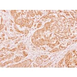 Immunohistochemistry - LARS2 antibody from Signalway Antibody (22745) - Antibodies.com