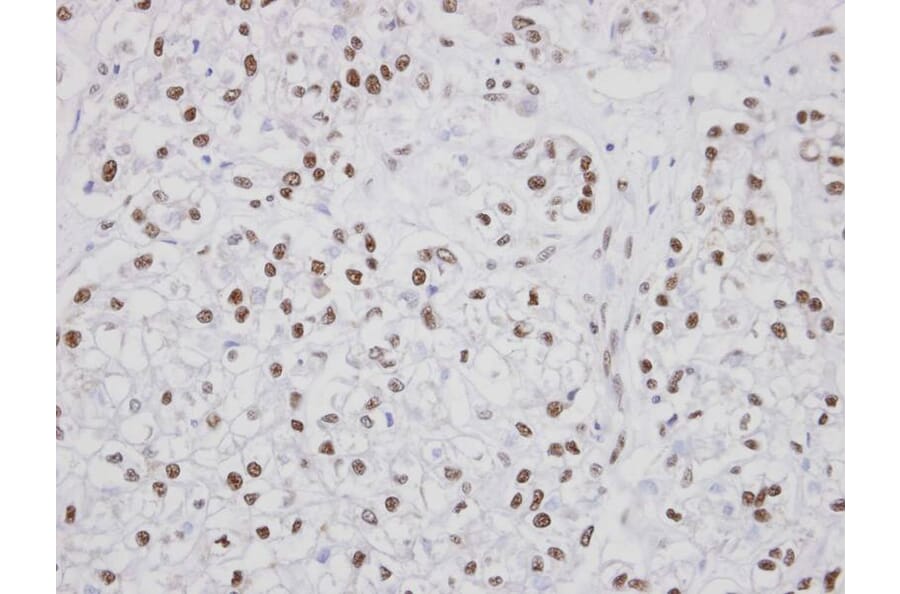 Immunohistochemistry - PUF60 antibody from Signalway Antibody (22762) - Antibodies.com