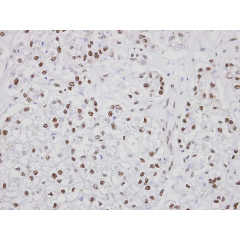 Immunohistochemistry - PUF60 antibody from Signalway Antibody (22762) - Antibodies.com