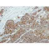 Immunohistochemistry - DAX-1 antibody from Signalway Antibody (22765) - Antibodies.com