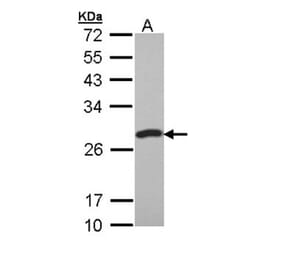 PCMT1 antibody from Signalway Antibody (22784) - Antibodies.com