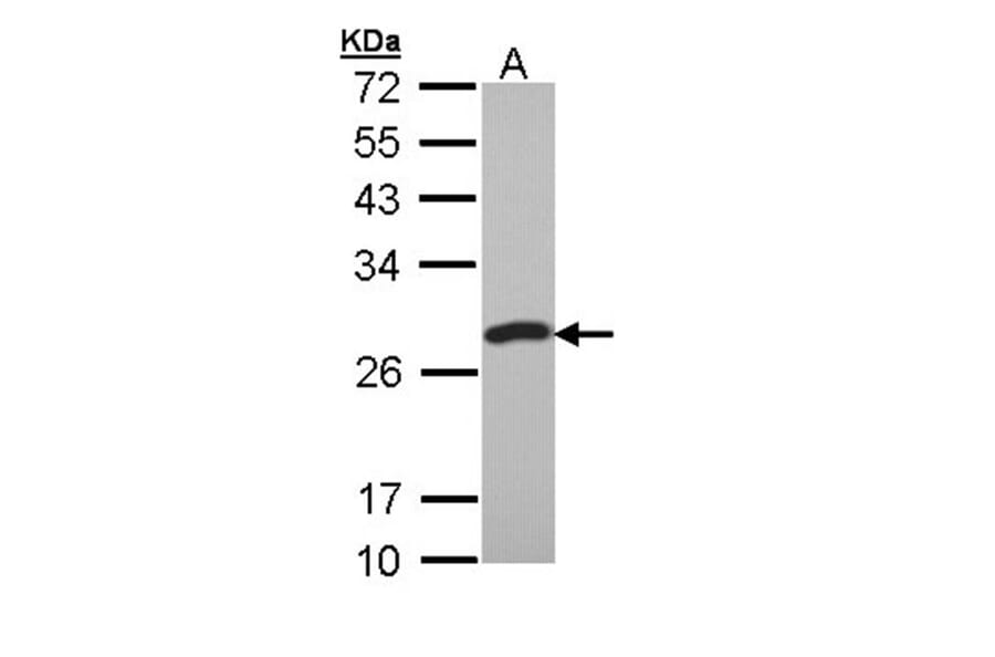 PCMT1 antibody from Signalway Antibody (22784) - Antibodies.com