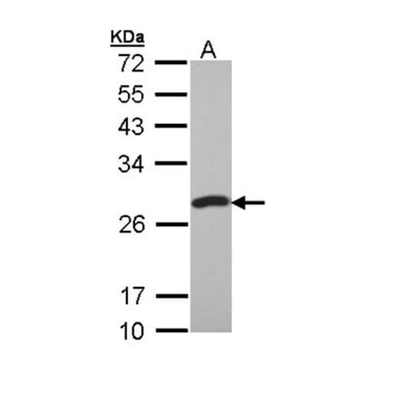 PCMT1 antibody from Signalway Antibody (22784) - Antibodies.com
