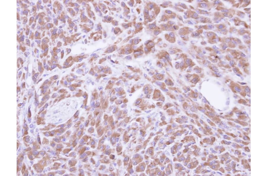 Immunohistochemistry - PCMT1 antibody from Signalway Antibody (22784) - Antibodies.com