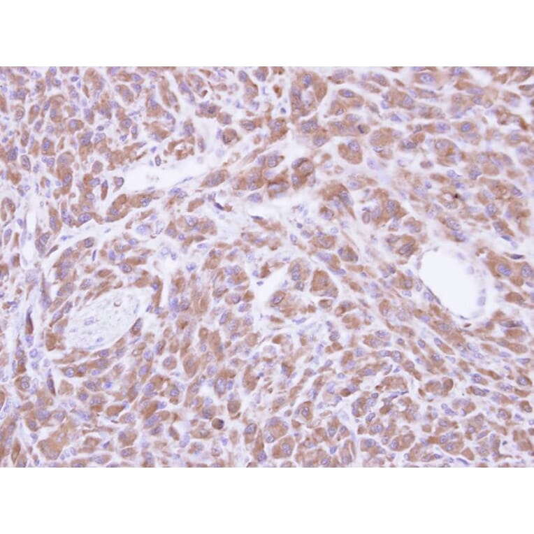 Immunohistochemistry - PCMT1 antibody from Signalway Antibody (22784) - Antibodies.com