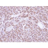 Immunohistochemistry - PCMT1 antibody from Signalway Antibody (22784) - Antibodies.com
