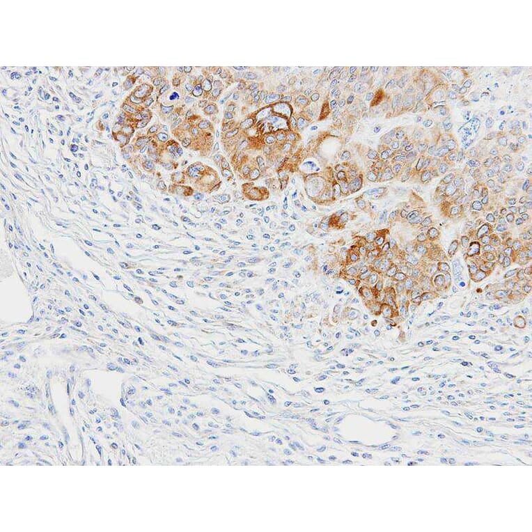 Immunohistochemistry - BAP31 antibody from Signalway Antibody (22800) - Antibodies.com