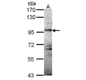 PRKD2 antibody from Signalway Antibody (22841) - Antibodies.com