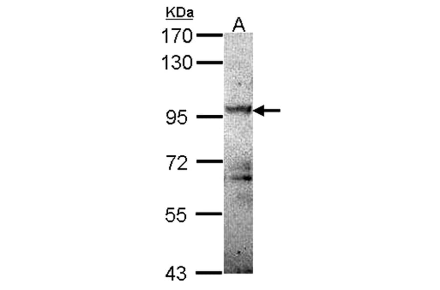 PRKD2 antibody from Signalway Antibody (22841) - Antibodies.com