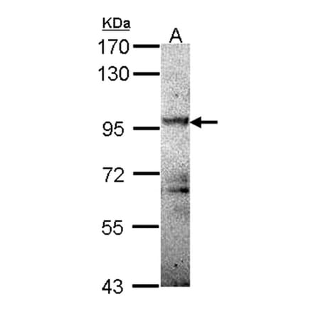 PRKD2 antibody from Signalway Antibody (22841) - Antibodies.com