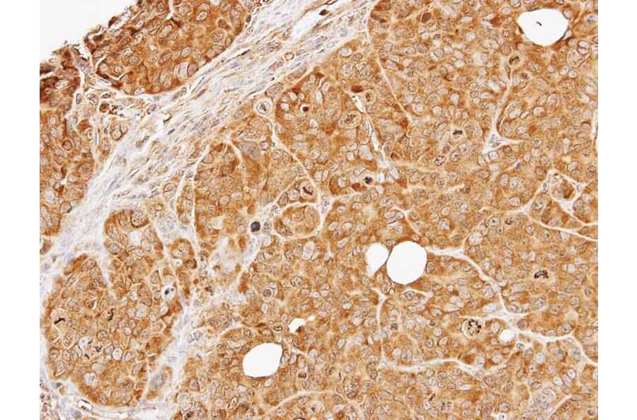 Immunohistochemistry - PRKD2 antibody from Signalway Antibody (22841) - Antibodies.com