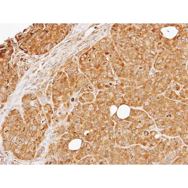 Immunohistochemistry - PRKD2 antibody from Signalway Antibody (22841) - Antibodies.com