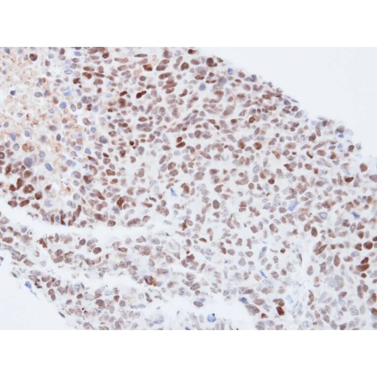 Immunohistochemistry - QIP1 antibody from Signalway Antibody (22843) - Antibodies.com