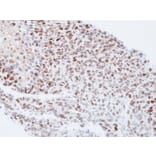 Immunohistochemistry - QIP1 antibody from Signalway Antibody (22843) - Antibodies.com