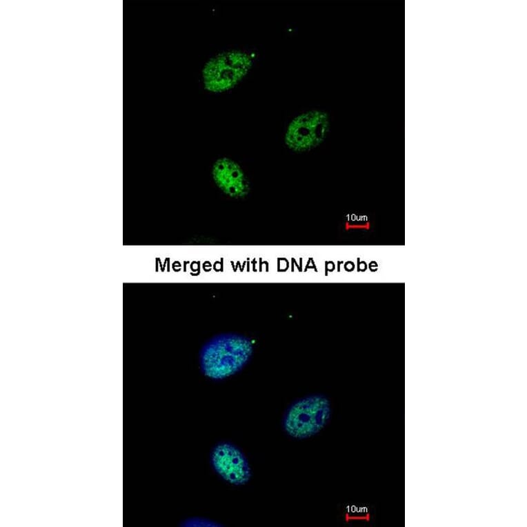 Immunofluorescence - QIP1 antibody from Signalway Antibody (22843) - Antibodies.com
