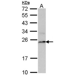 PSMB8 antibody from Signalway Antibody (22848) - Antibodies.com