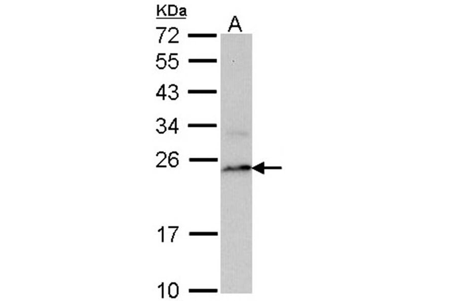 PSMB8 antibody from Signalway Antibody (22848) - Antibodies.com