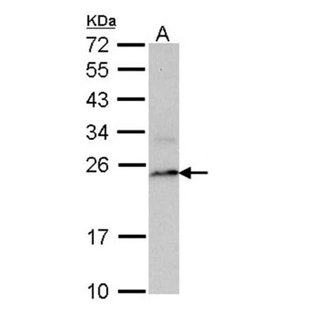 PSMB8 antibody from Signalway Antibody (22848) - Antibodies.com